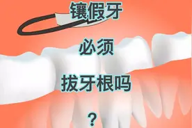 镶假牙必须拔牙根吗？ #老年人 #口腔健康 #健康科普视频封面