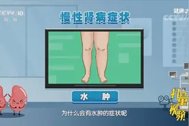 慢性肾病会导致排水功能减退，水在体内潴留会引起水肿视频封面