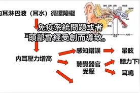耳水不平衡，这样做可以缓解视频封面