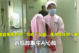 活在蒙面下“马脸”女孩，手术后成功“换脸”，故事背后令人心酸视频封面