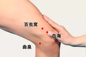 荨麻疹发作，浑身瘙痒，刺激大腿上的“百虫窝穴”，祛风、止痒视频封面
