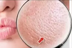 经常化妆对皮肤有害吗？这些化妆常识，得注意！视频封面