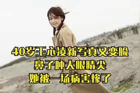 40岁王心凌新写真又变脸，鼻子肿大眼睛尖，她被一场病害惨了视频封面