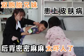 天气干燥，双胞胎患上皮肤病，后背密密麻麻好吓人，宝妈赶紧买药视频封面
