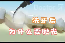 你知道洗牙后为什么要抛光吗？这点要注意，别承受了还未达到效果视频封面