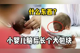小婴儿脑后长了个大包块，这是什么东西？视频封面