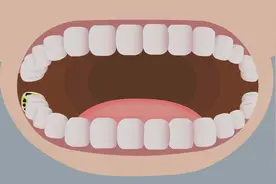 儿童虫牙疼怎么办？视频封面