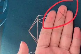 中指上有疤痕在手相学中，预示着此人到中年得注意事业变动视频封面