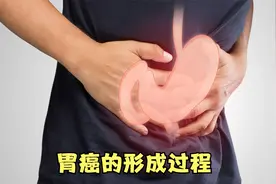 原来胃癌是这样得来的！医生揭秘形成过程，看完涨知识了视频封面