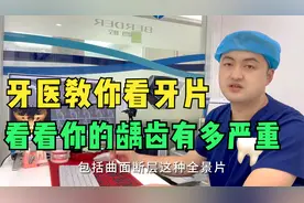 牙医教你看牙片，看看你的龋齿有多严重！视频封面