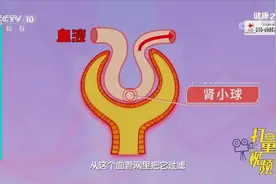 糖尿病为何会损伤肾脏？专家进行讲解，来看动画演示|健康之路视频封面
