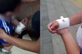 网传浙江一小学老师用刀伤学生，警方：和网传有差距，正在调查中视频封面