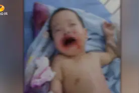 1岁男童误食管道疏通剂    医生：家长要多注意！视频封面