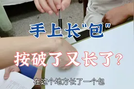 手上长“包”，是不是按破了又长了？怎么处理？听听肖教授分析视频封面