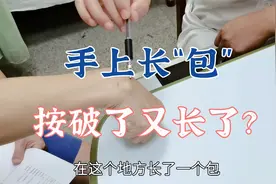 手上长“包”，是不是按破了又长了？怎么处理？听听肖教授分析视频封面