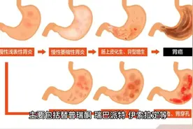 3药增强胃黏膜屏障，抗炎抗氧化，促进胃溃疡愈合，消除腹痛癌变视频封面
