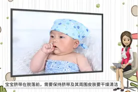 宝宝出生以后脐带多久会脱落？视频封面