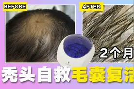 真人实测3款网红生发帽！便宜的更好用？