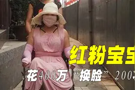 整容狂人红粉宝宝，花400万“换脸”200次，至今不敢真面示人视频封面
