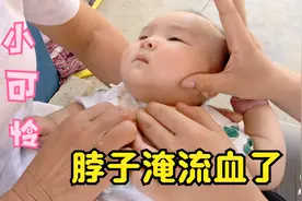 王润卓脖子淹流血了，妍妍用香油抹一下管用吗？婆婆看了很心疼