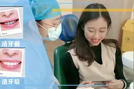 带您体验牙博士口腔超声波洁牙过程，洁牙我们可是认真的视频封面