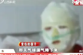 又酿悲剧！氢气球落地爆炸，三名儿童受伤严重，头发也被烧焦！视频封面
