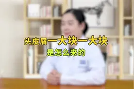 头皮屑很大块，代表头皮状况异常，主要有3点原因，该如何解决？