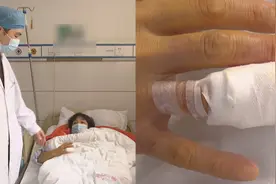 女子手指出现莫名疼痛，怀疑患上怪病，医生一番话，把她吓一跳视频封面