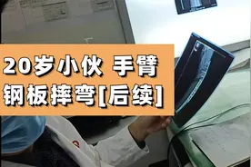 后续 | 20岁小伙患骨巨细胞瘤，摔跤后检查，发现第二次复发视频封面