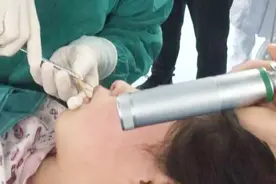 女童边玩蹦床边吃热狗，17厘米竹签扎入喉咙刺穿脑干，家人吓猛！视频封面