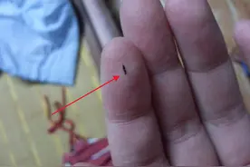 家里有跳蚤？不用怕，只需这样做，跳蚤就通通不见了！视频封面