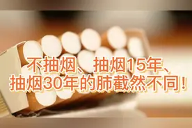 内窥镜下不抽烟、抽烟15年、抽烟30年的肺截然不同，你是哪种？