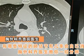 有哪些特征的肺结节有几率会自己消失？胸外科乔医生教你一招分辨视频封面