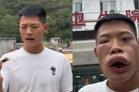 男子为博眼球生吃蜜蜂！结果变怪人进医院：他赚钱我一点也不羡慕视频封面
