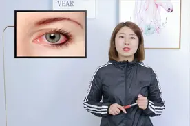 眼睛出现红血丝，是怎么回事？躲不开这5大原因，不少人中招视频封面