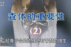 患者走路困难一跛一跛是什么原因？肖教授讲解查体的重要性（2）视频封面