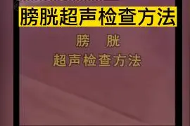 膀胱超声检查方法