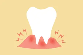 拔智齿后头疼怎么回事？正常吗？用不用吃药？听听专家怎么说