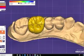 如何快速简单的用EXO设计出漂亮的牙齿