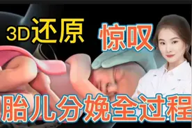 精彩3D医学视频还原孕妇分娩全过程 母爱伟大 惊叹不已视频封面