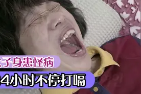 女子身患怪病，24小时不停打嗝，病因终被查明视频封面