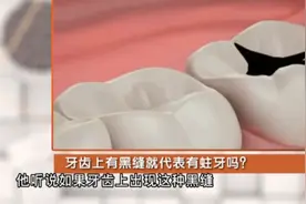 误区解答！牙齿上有黑缝，就是长蛀牙了吗？视频封面