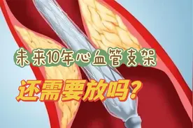 未来10年心脏治疗有哪些新理念？支架还放吗？看看精准医疗什么样