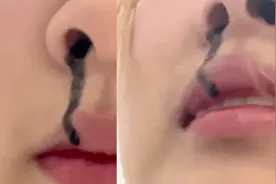 女子眼线笔漏水到眼睛里，最后从鼻子流了出来