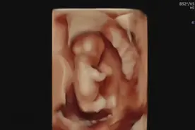 妈妈肚子里的小小拳击手，哈哈哈...很带劲，有点小凶猛喔！！视频封面