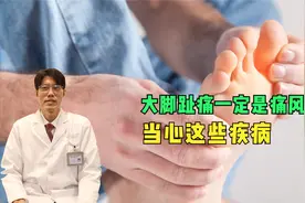 大脚趾痛一定是痛风吗？一般是哪个部位开始痛？听专家说视频封面