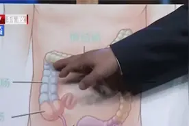 直肠癌发病部位有何不同，专家详细讲解，快来看看吧视频封面