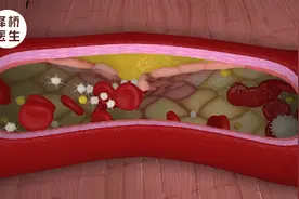 高血压患者如何饮食？这几个建议一定要记牢！视频封面