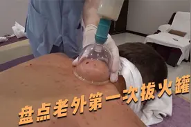 盘点老外体验拔火罐：小伙吓的当场流眼泪，拔完之后浑身轻松！视频封面
