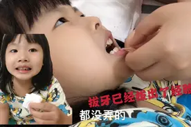 轩妈拔牙已经拔出了经验，教你如何轻松帮忙小孩拔牙，次次成功视频封面